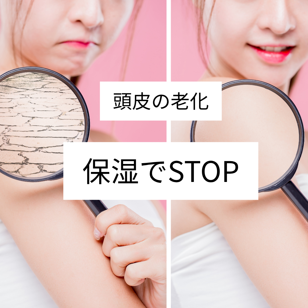 忘れてない？頭皮と顔は繋がってる